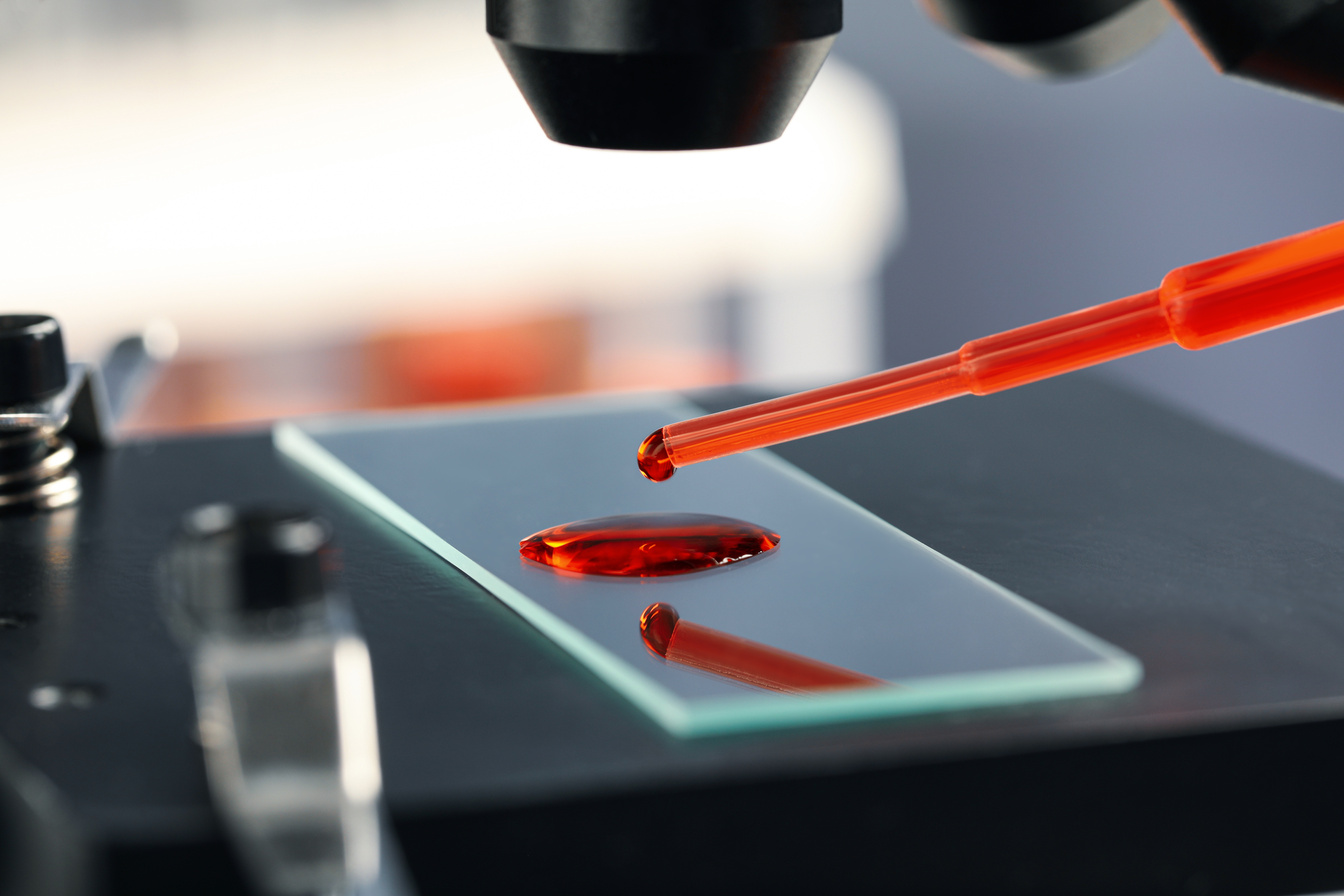 Dripping Sample of Red Liquid onto Slide under Microscope in Lab